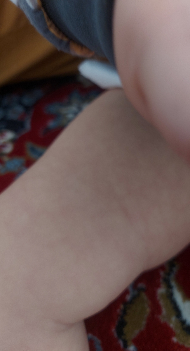 پوست دخترم چرا اینجوره پوست دخترم چرا اینجوره