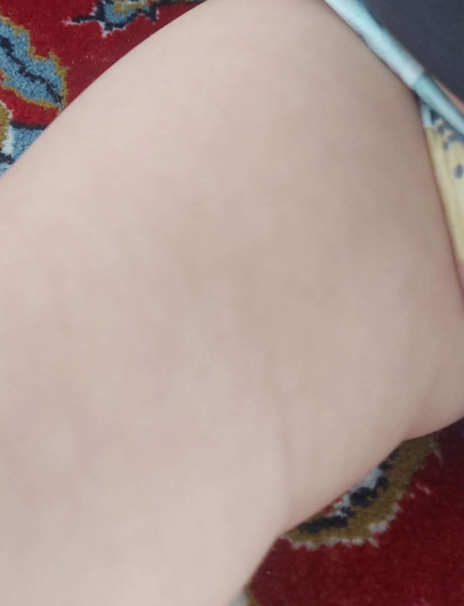 پوست دخترم چرا اینجوره پوست دخترم چرا اینجوره