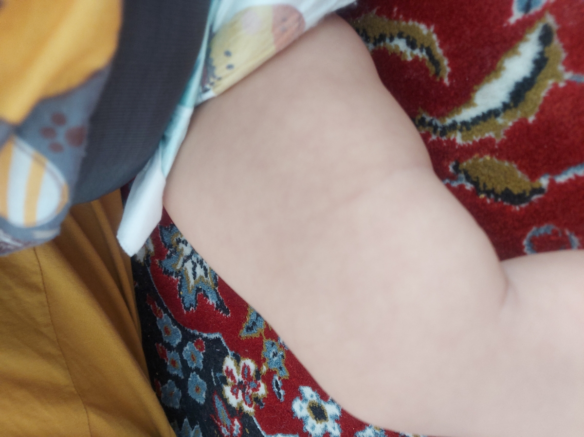 پوست دخترم چرا اینجوره پوست دخترم چرا اینجوره