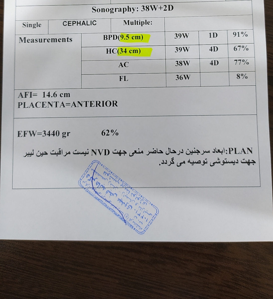 اخرین سونو گرافیم