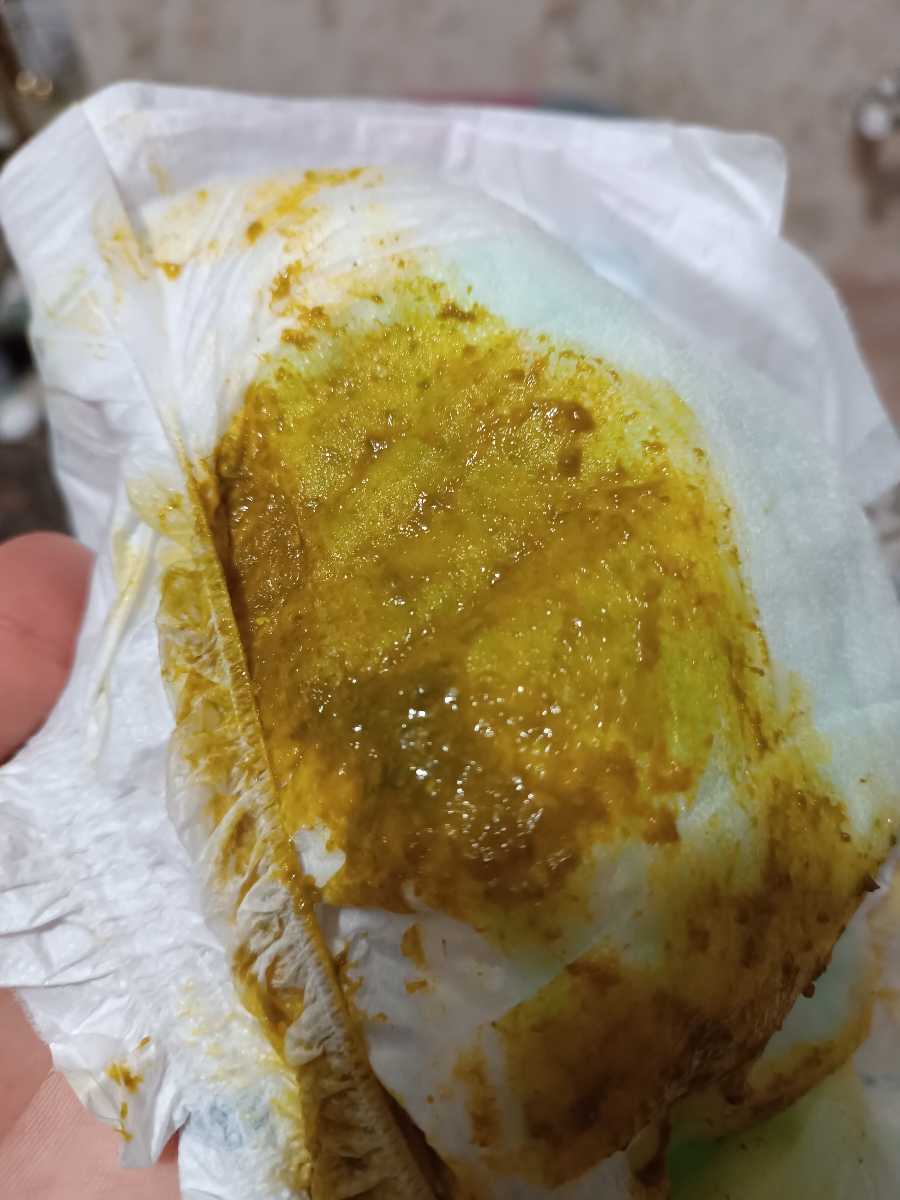 مدفوع نوزاد روزی ۳،۴ بار در روز همراه با عکس مدفوع نوزاد روزی ۳،۴ بار در روز همراه با عکس