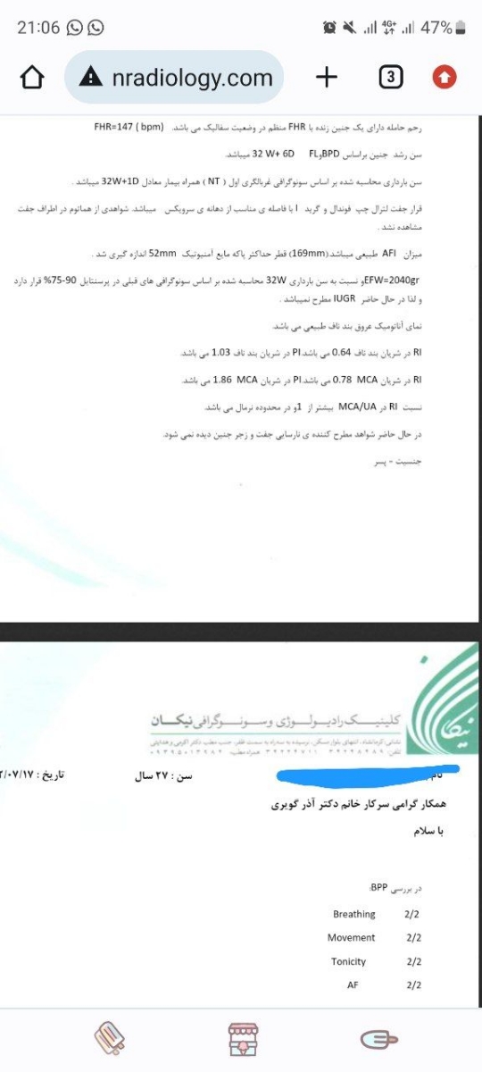 سونوگرافی وزن و iugr سونوگرافی وزن و iugr