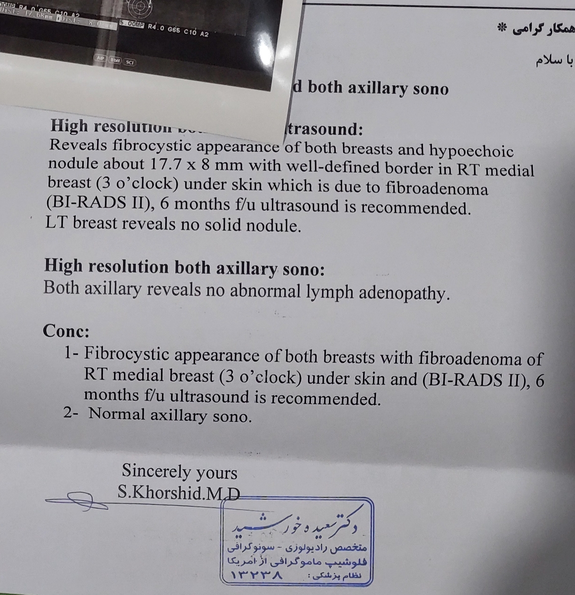 فوری تفسیر ماموگرافی و سونوگرافی سینه فوری تفسیر ماموگرافی و سونوگرافی سینه