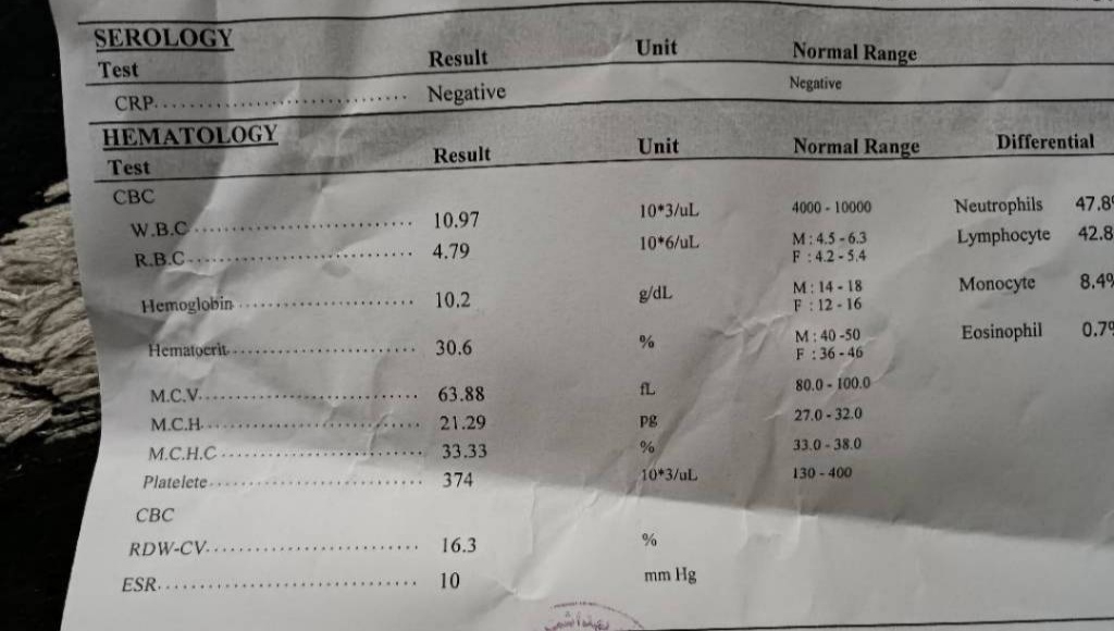 تب پسر یازده ماهم