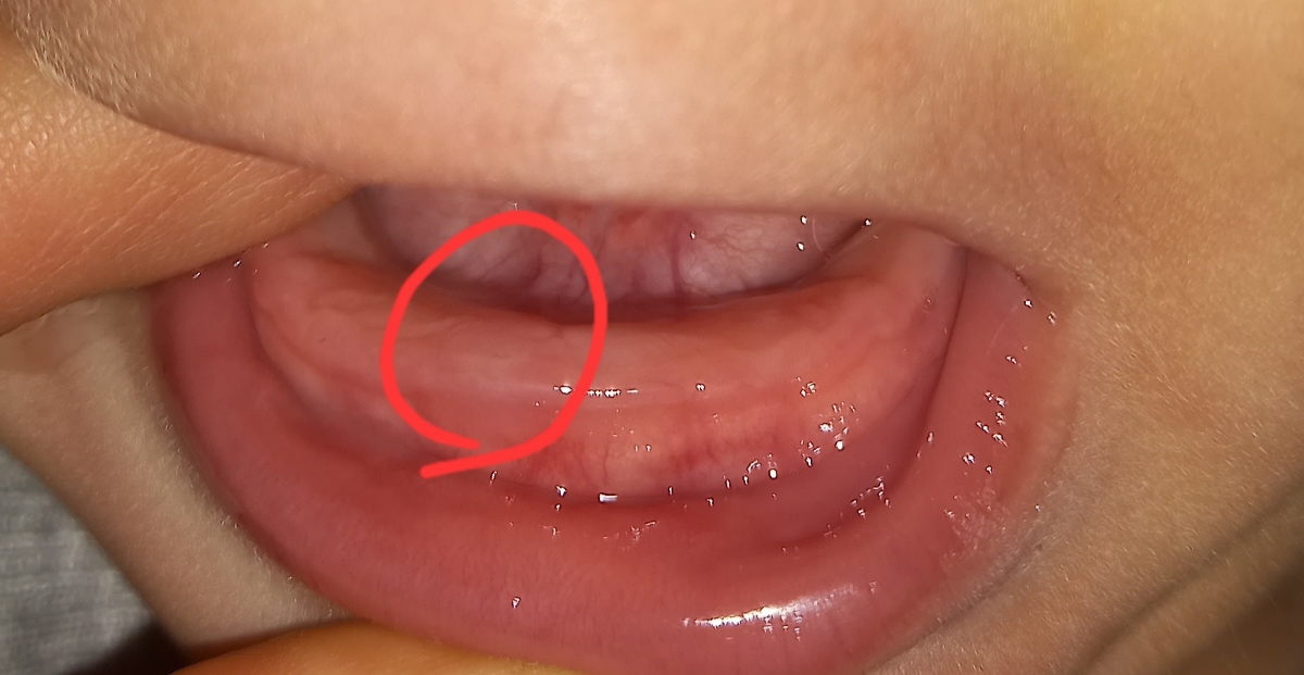 بررسی جواب آزمایش مدفوع بررسی جواب آزمایش مدفوع