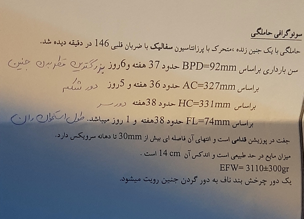 سونوگرافی در هفته ۳۷