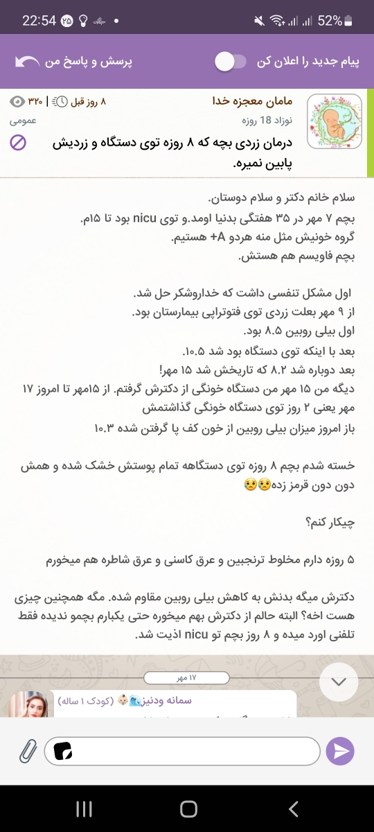 روش رفع زردی نوزاد ۱۸ روزه