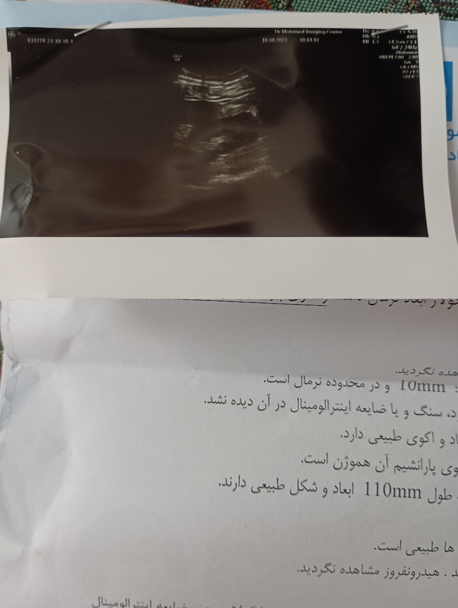 آزمایش خون و سونوی شکم و لکن