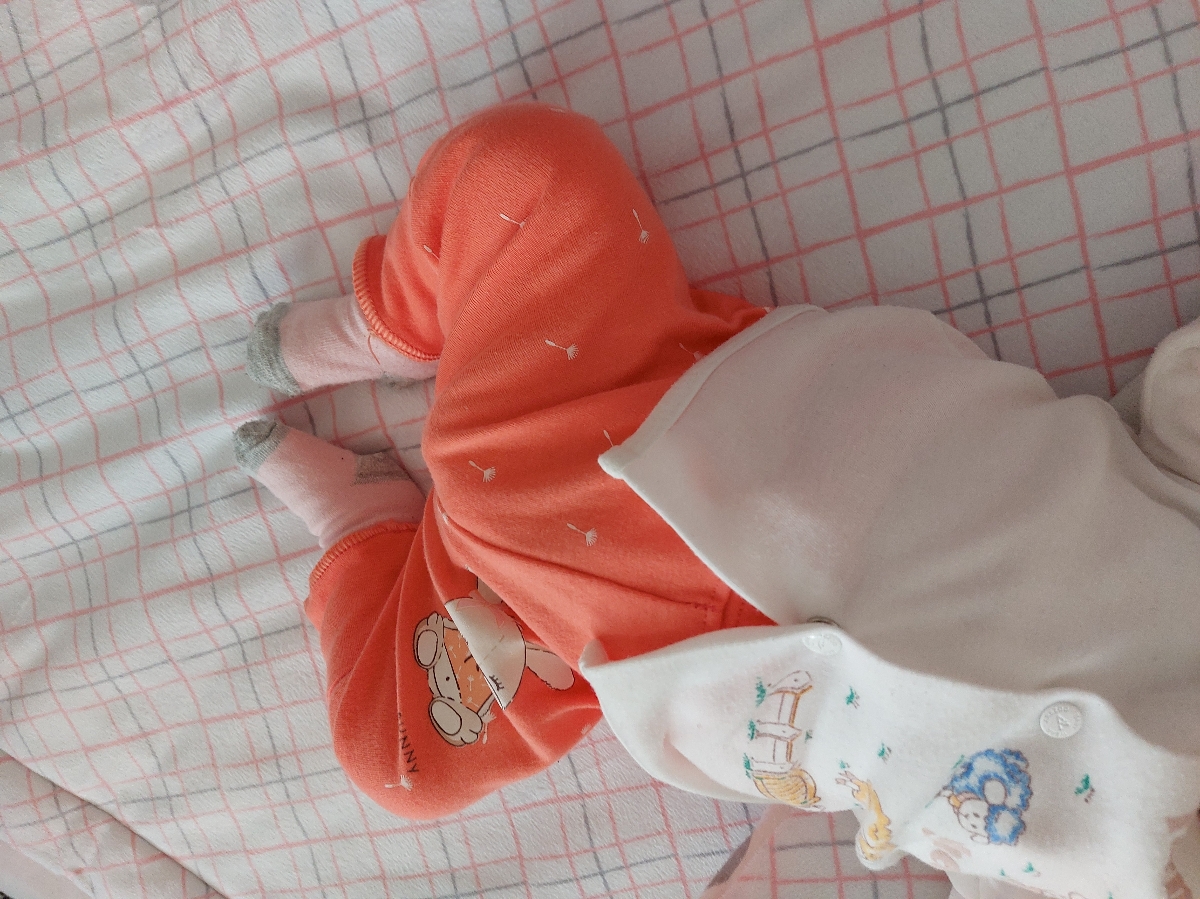 حالت پای نوزاد (عکس)