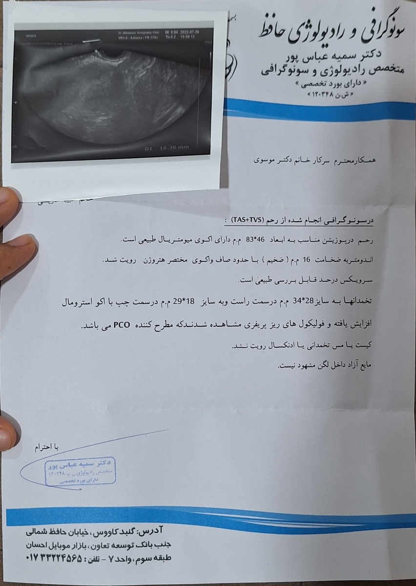 خونریزی شدید بدون قطعی
