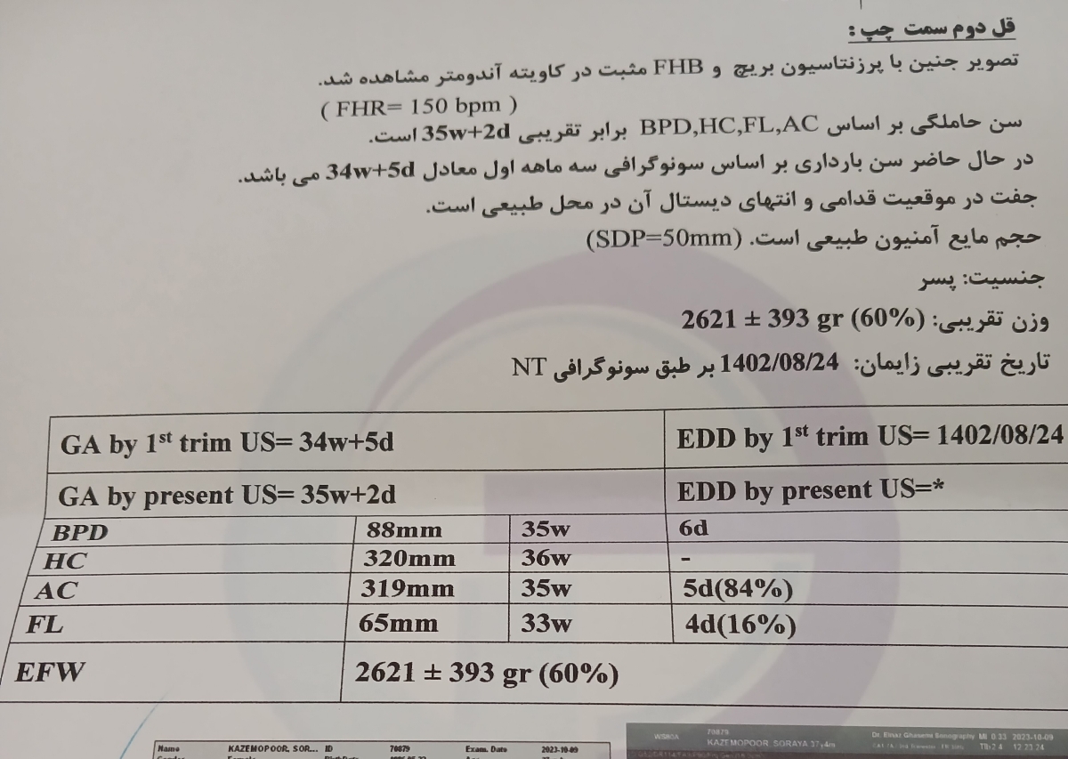 رشد جنین در۳۶هفته و۶روز طول فمور وهومروس کمتر ازصدک۵