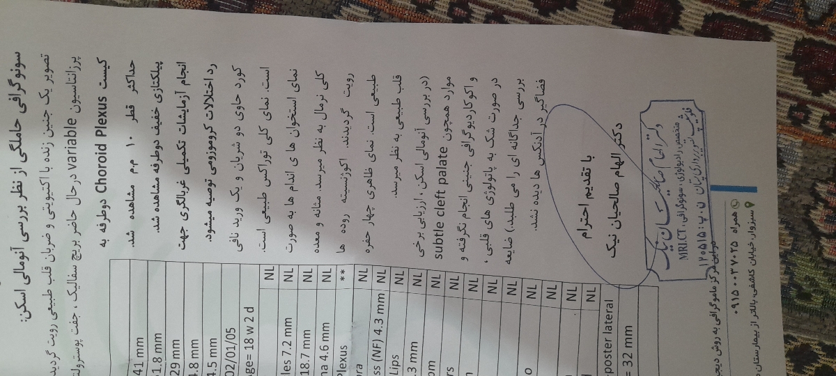 تفسیر سنو انومالی تفسیر سنو انومالی