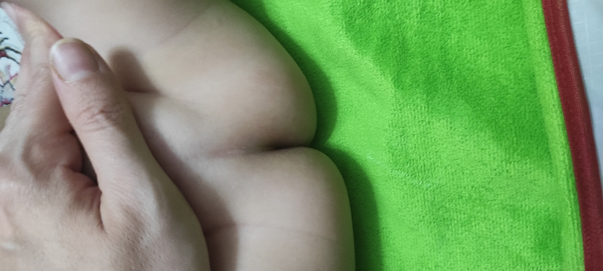 علت قرمز شدن دور مقعد چیست