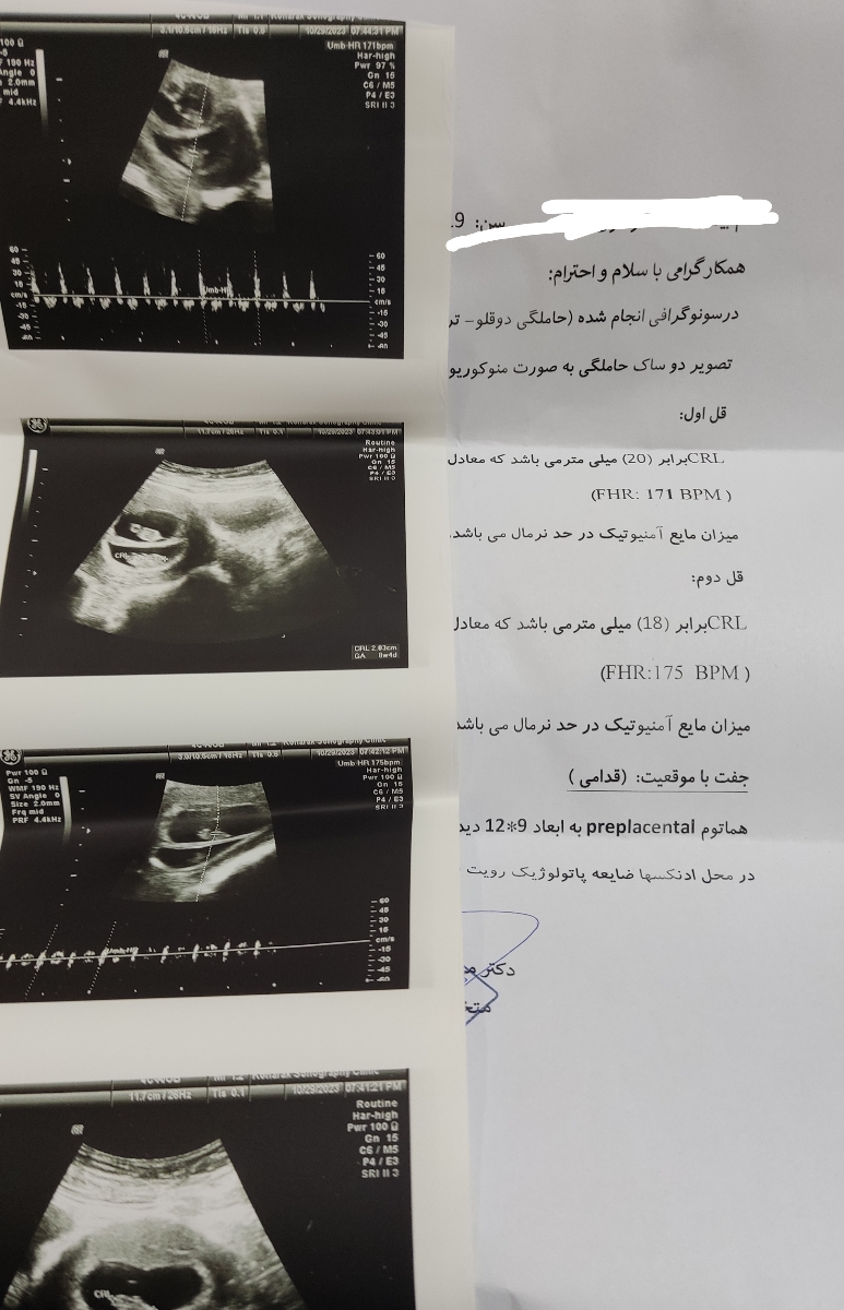 تفسیر سنوگرافی ۸ هفته ؟؟