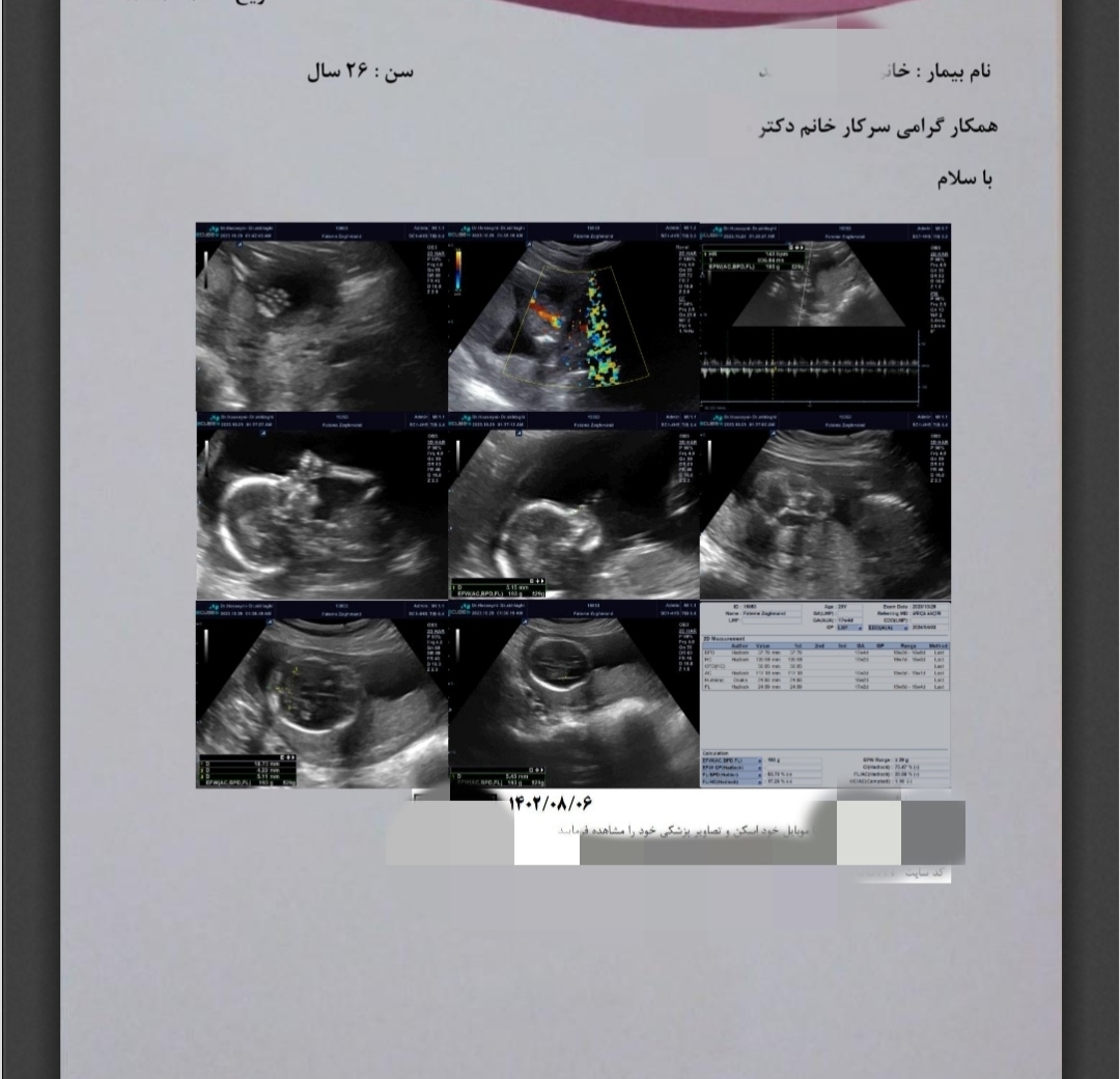 جواب سونوگرافی غربالگری آنومالی