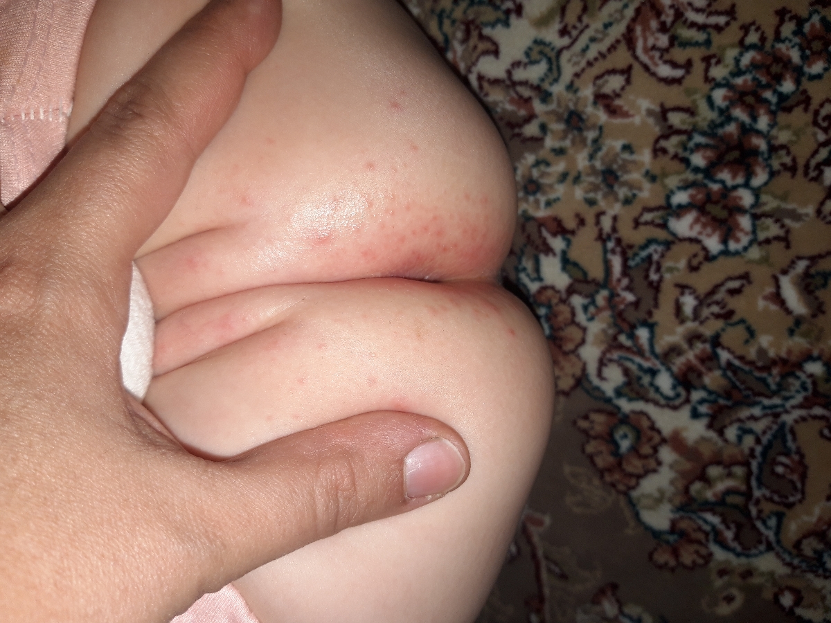 باسن بچم دون دون قرمز شده