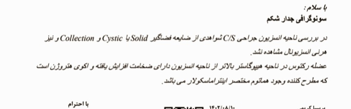 خوردن کپسول کلیندامایسین ۳۰۰ در شیردهی خوردن کپسول کلیندامایسین ۳۰۰ در شیردهی