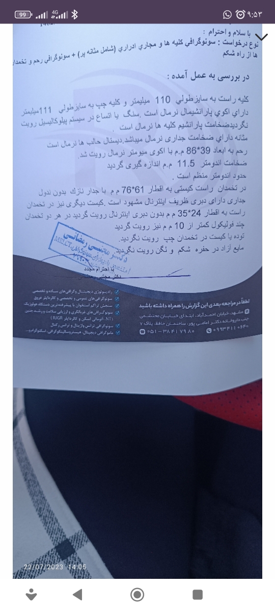 آیا کیستم بر طرف شده ؟ سونو دادم