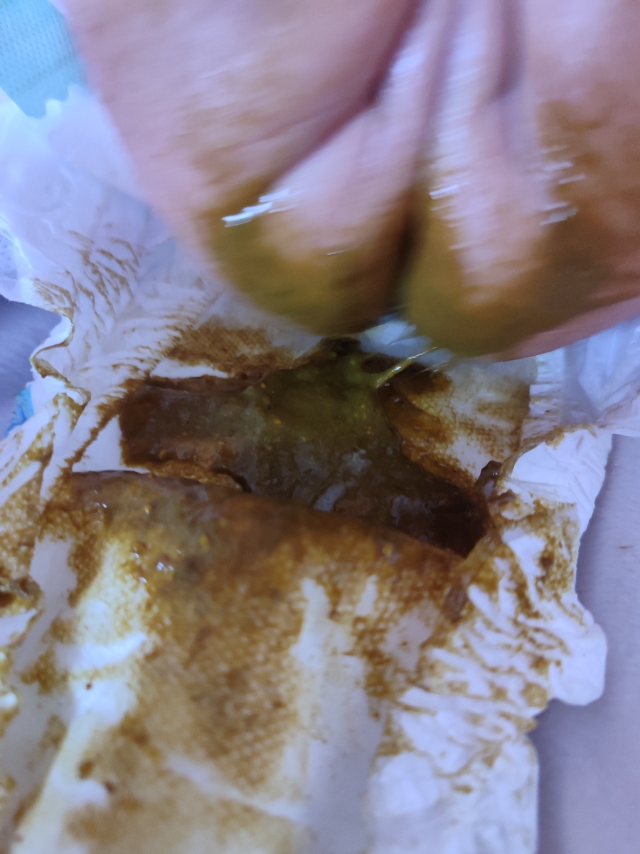 مدفوع نوزاد۲۵روزه سبز رنگ مدفوع نوزاد۲۵روزه سبز رنگ