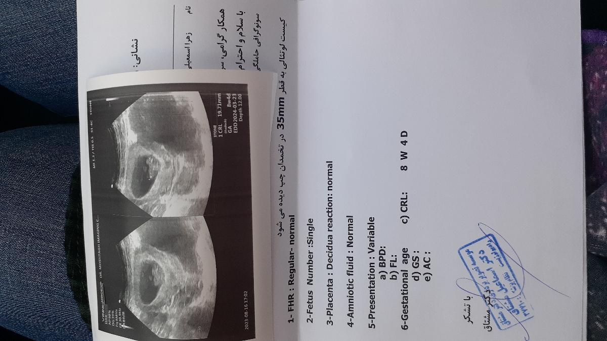 سونو گرافی تشکیل قلب سونو گرافی تشکیل قلب