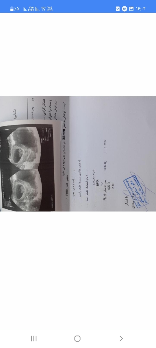 سونو گرافی تشکیل قلب سونو گرافی تشکیل قلب