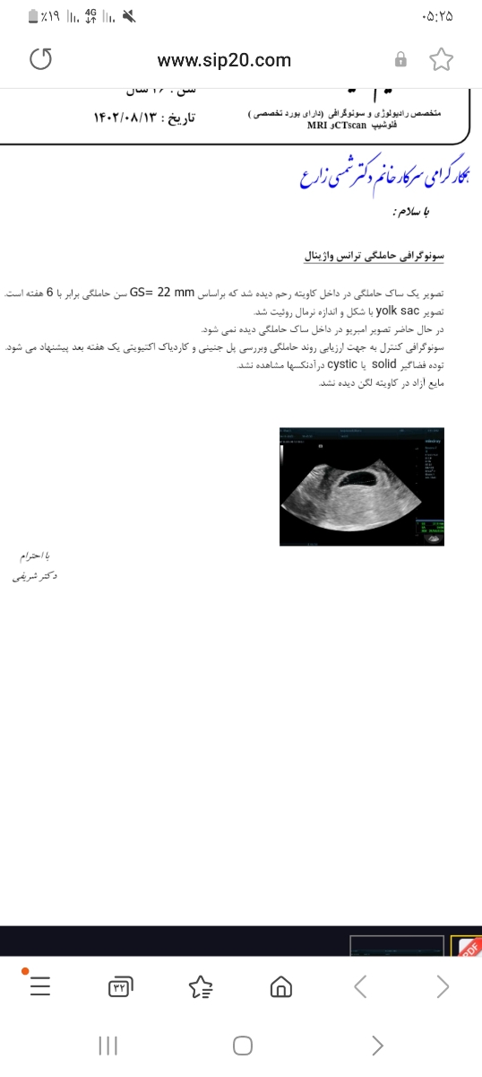 سونوگرافی ۶هفته ایی