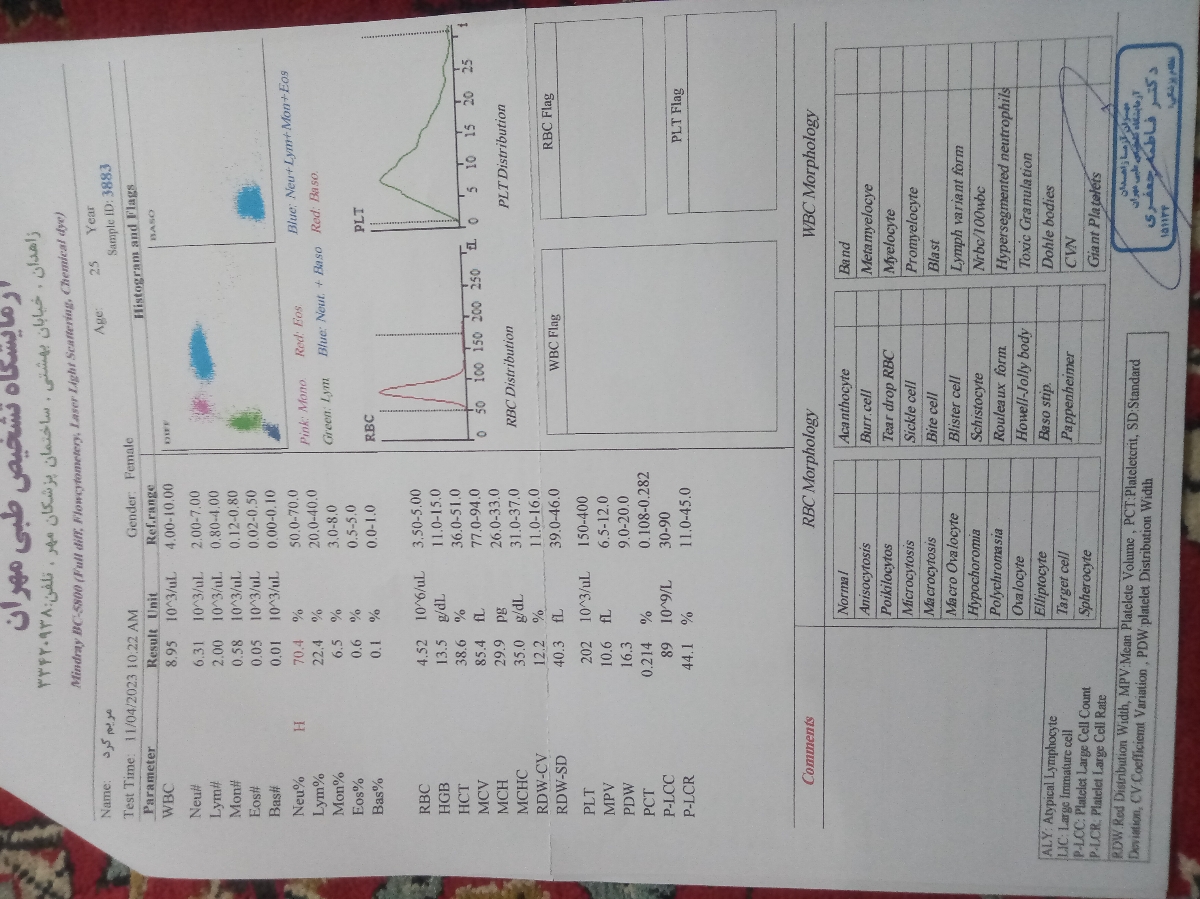 تفسیر آزمایش کامل و سونو NT تفسیر آزمایش کامل و سونو NT