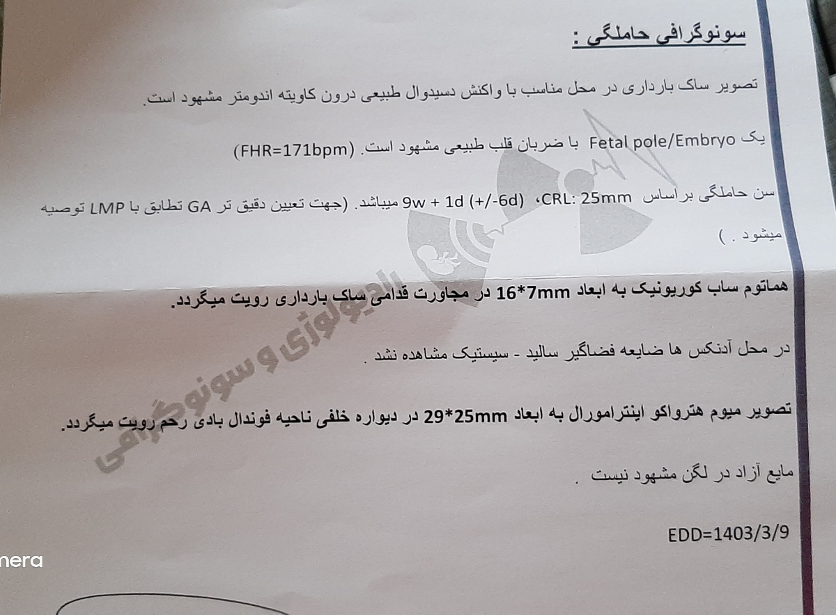 سونو NT در ۱۲ هفته و ۱ روز سونو NT در ۱۲ هفته و ۱ روز
