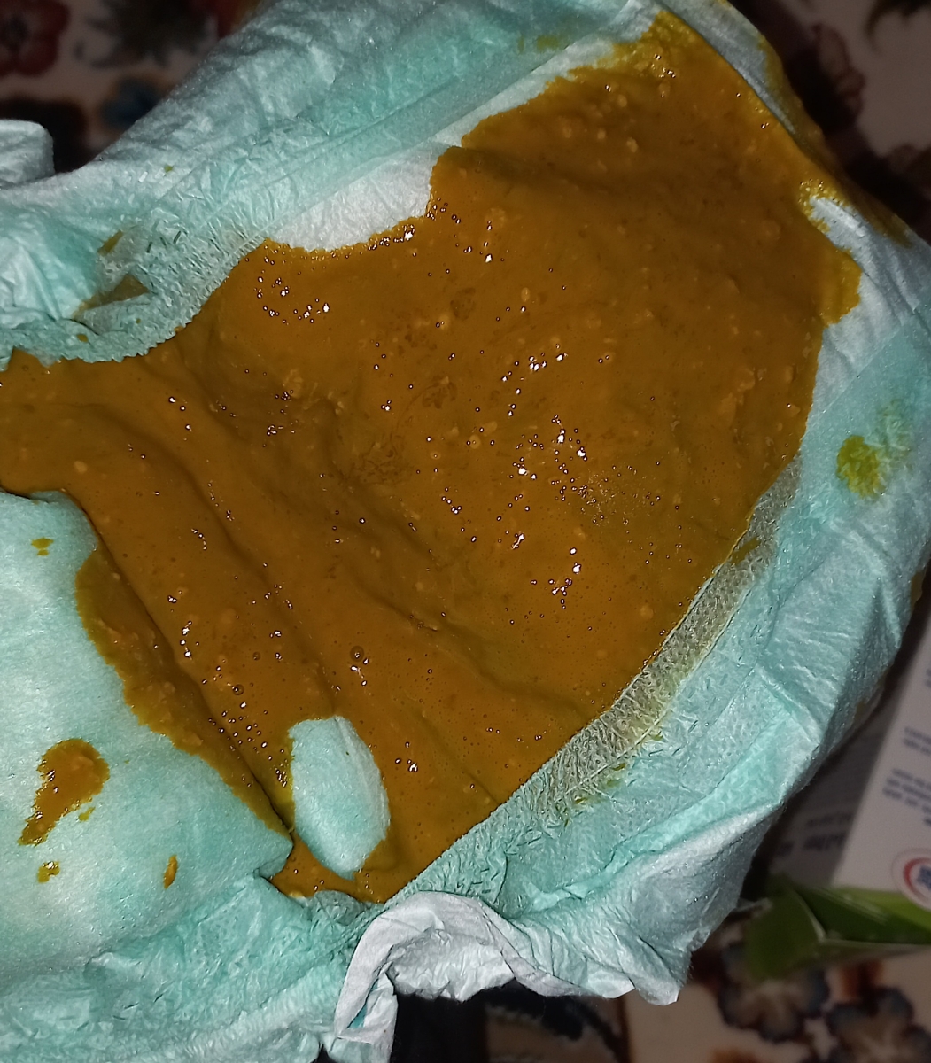 شروع شیرخشک نان اچ ا و یبوست و جوش هایی صورت شروع شیرخشک نان اچ ا و یبوست و جوش هایی صورت