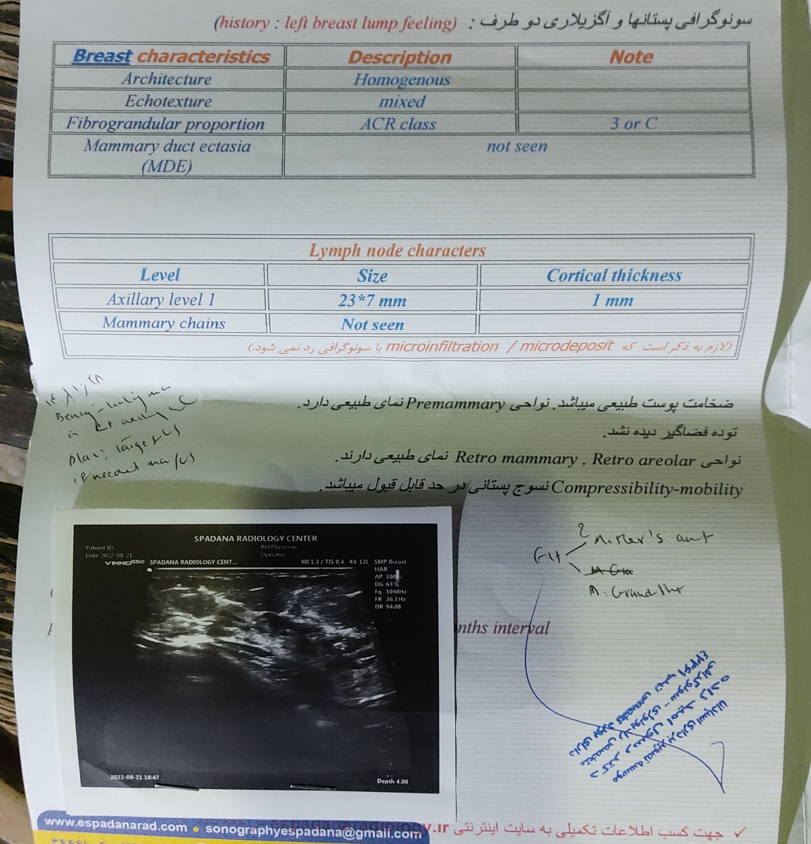 لطفا خانمها و خانم دکتر راهنمایی کنید دررابطه با توده در سینه؟؟؟؟؟ لطفا خانمها و خانم دکتر راهنمایی کنید دررابطه با توده در سینه؟؟؟؟؟
