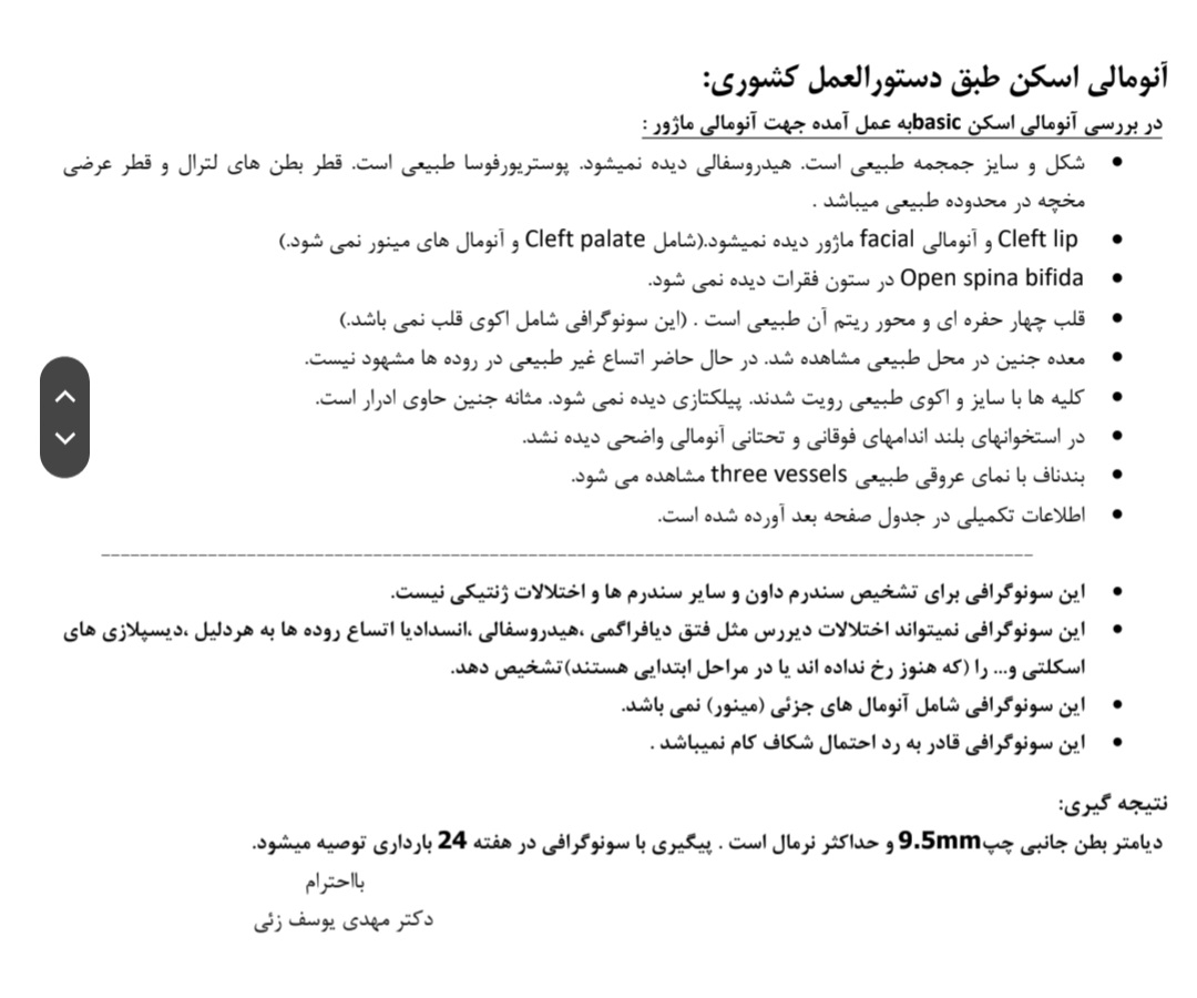 بطن جانبی مغز در آنومالی