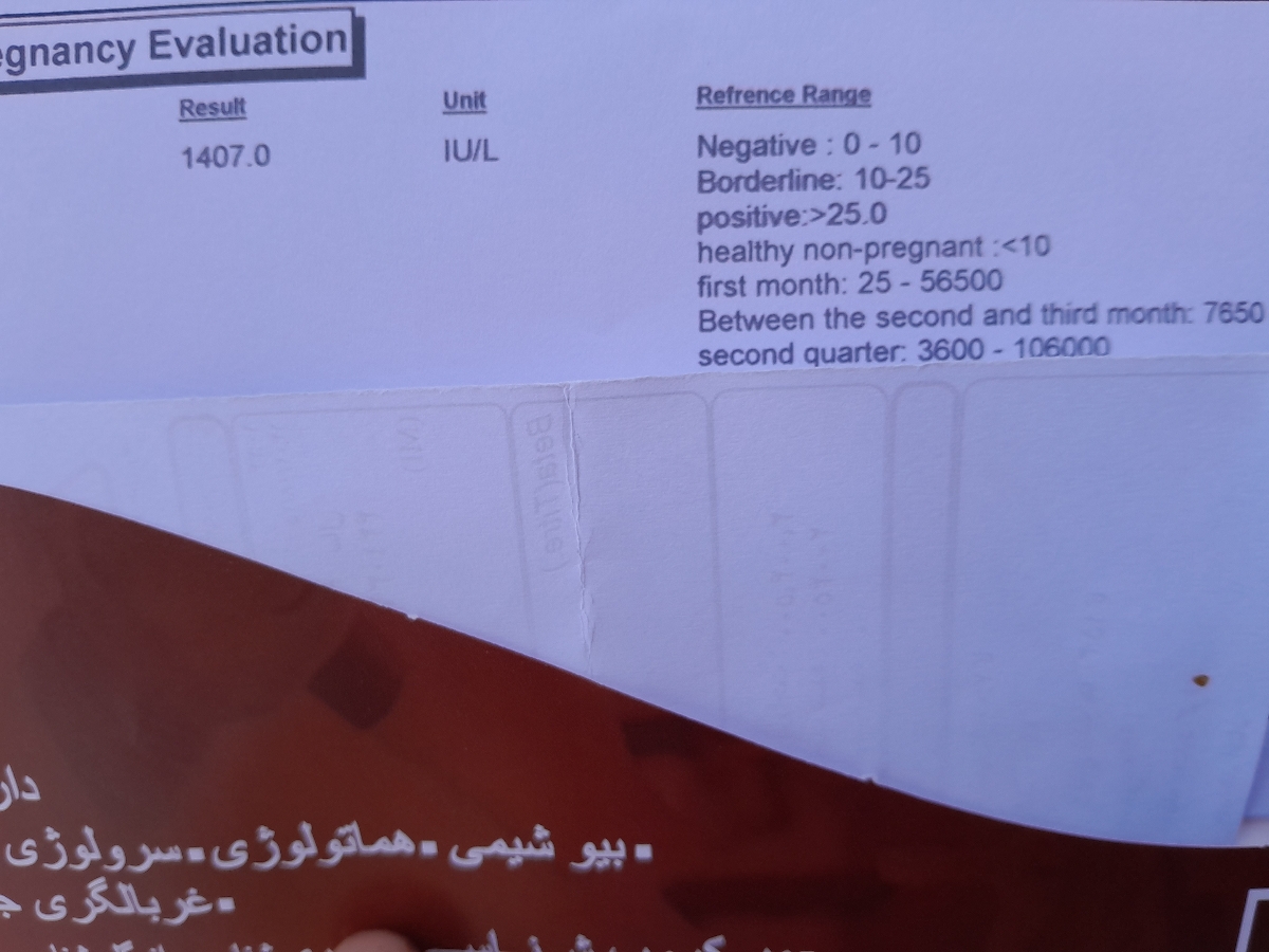 دکتر روند افزایش بتا