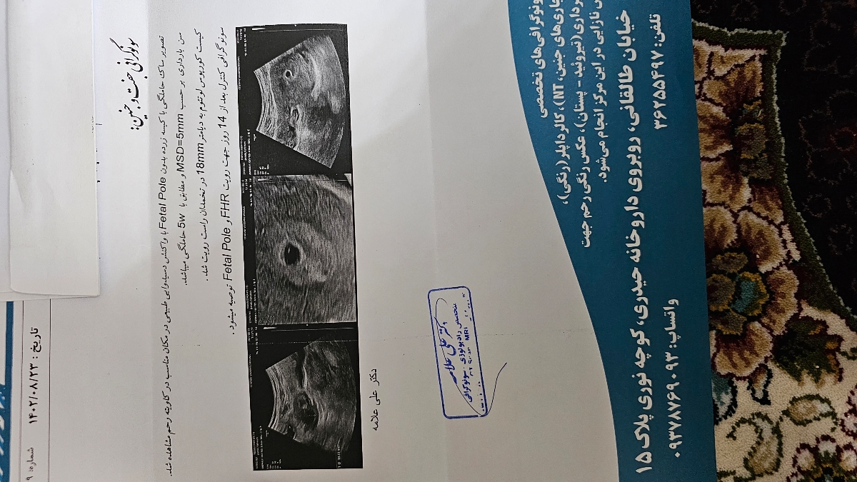 ازمایش بتا وجوابهای متفاوت ازمایش بتا وجوابهای متفاوت
