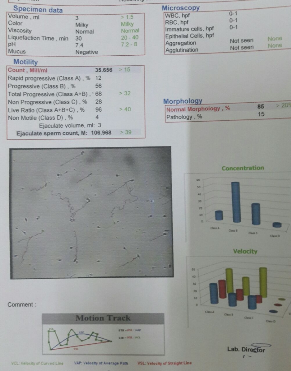 تفسیر آزمایش اسپرم ......