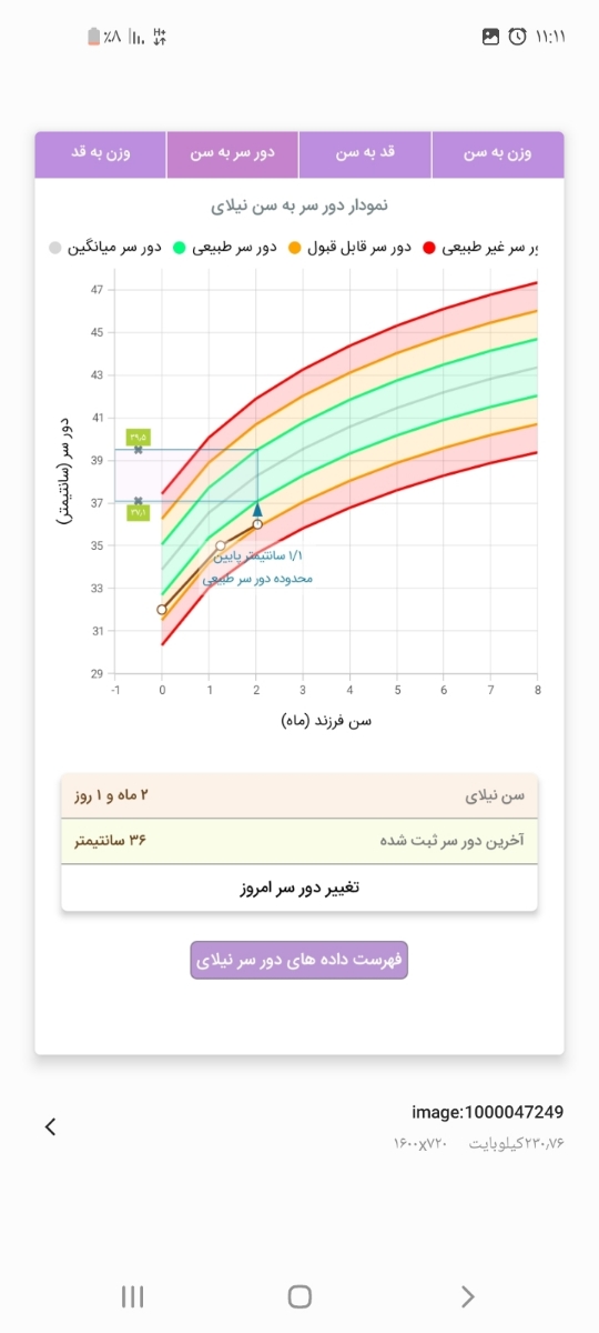 دور سر نوزاد دو ماهه