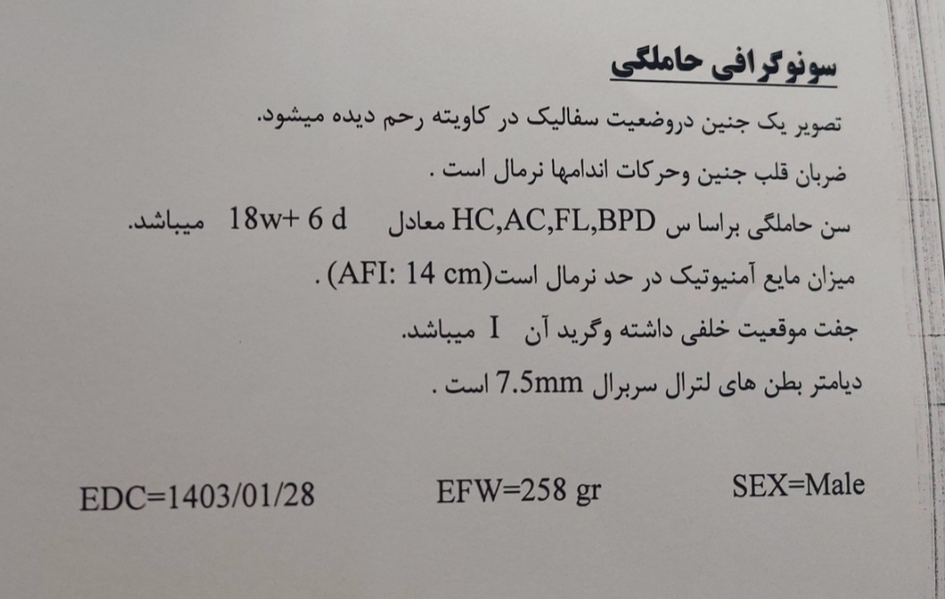 بطن جانبی مغز در آنومالی