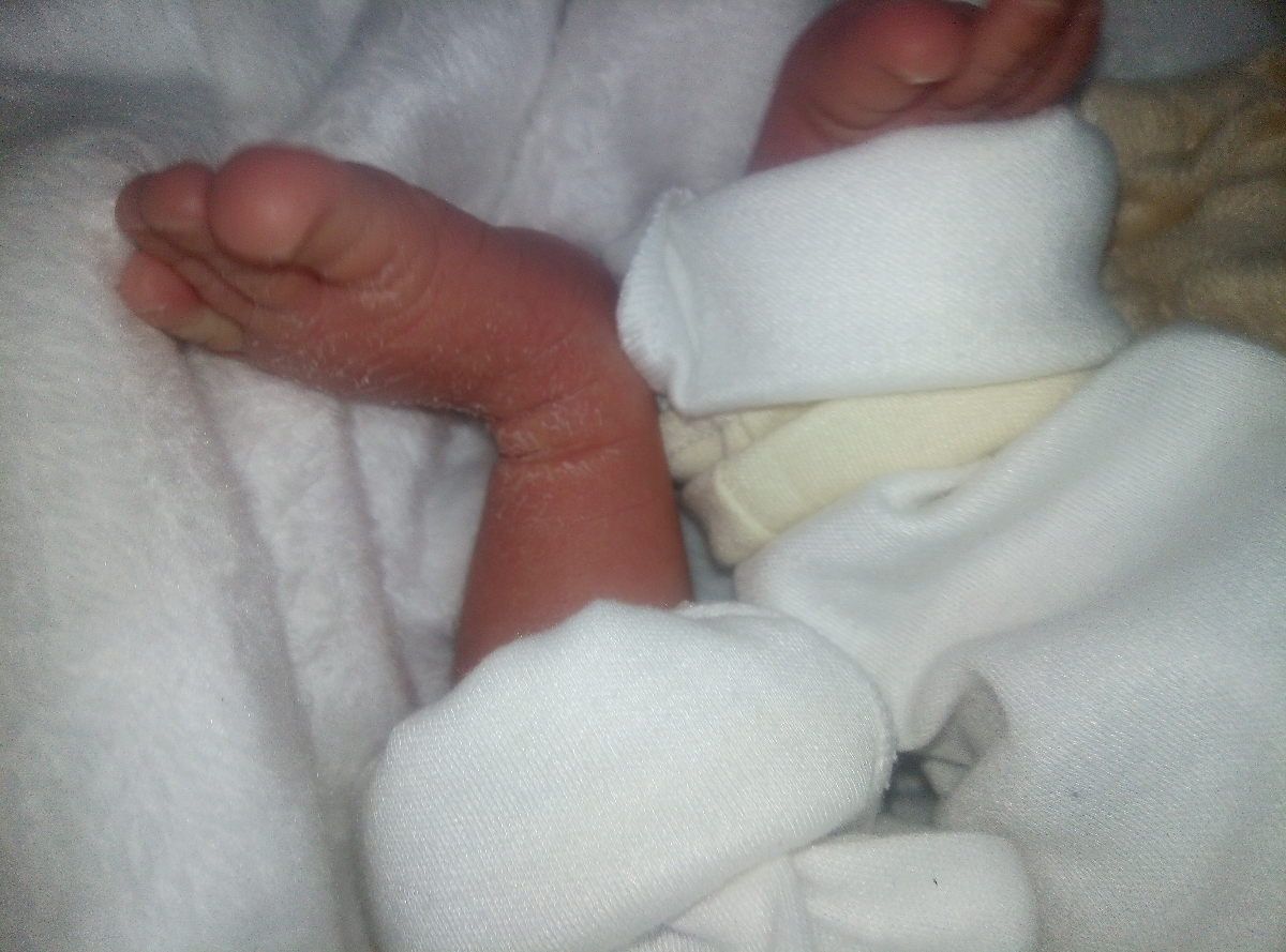 پای بچم چرا پوست پوست شده پای بچم چرا پوست پوست شده