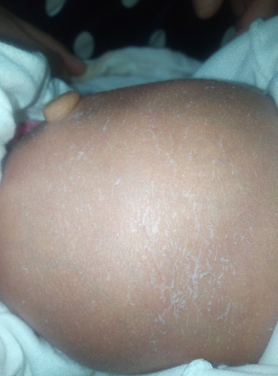 پای بچم چرا پوست پوست شده پای بچم چرا پوست پوست شده