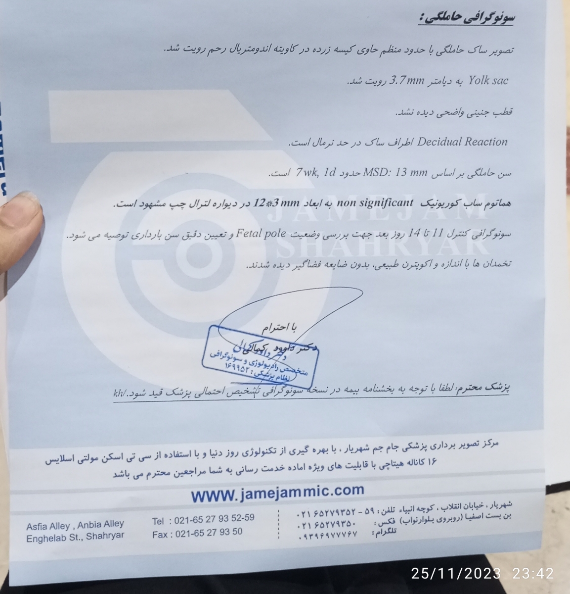 خونریزی در بارداری خونریزی در بارداری