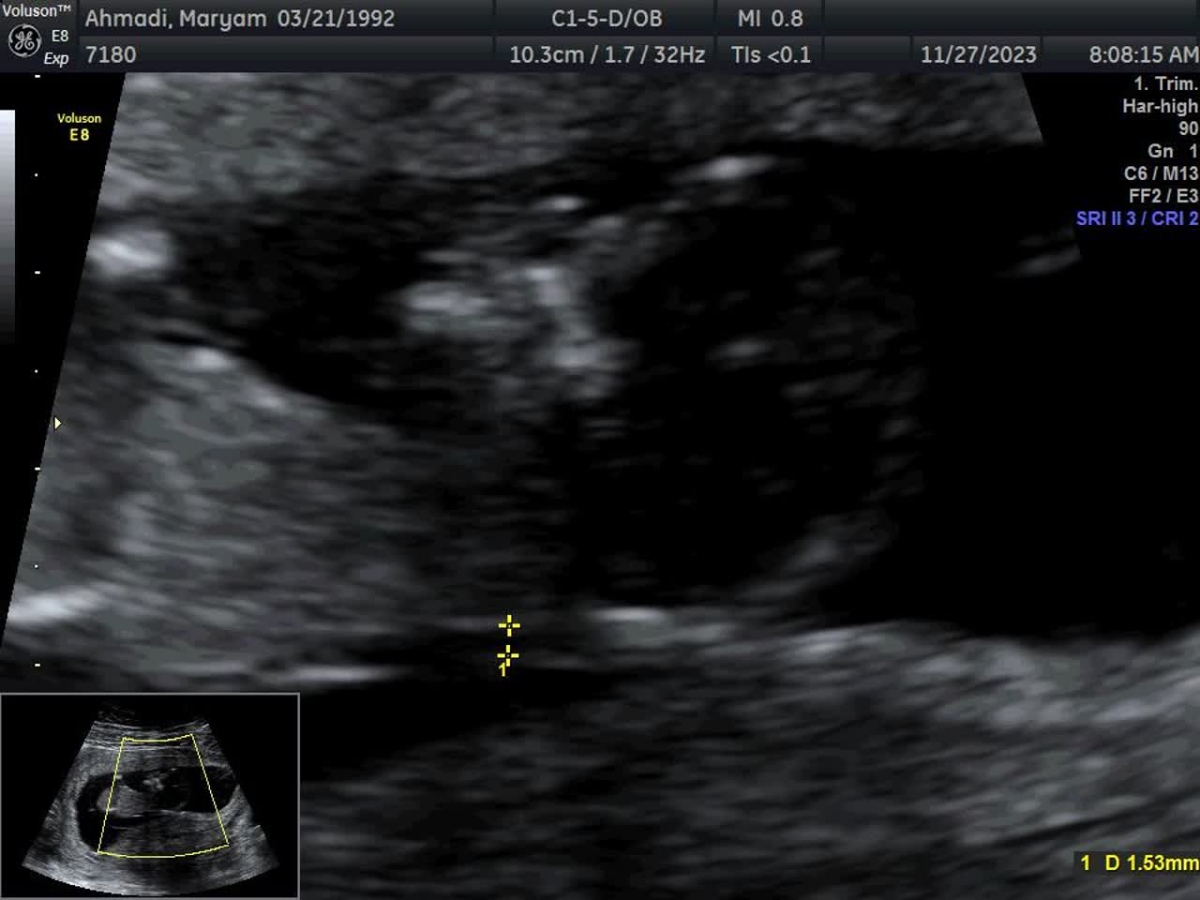 متخصصین تعیین جنسیت لطفا بیاید 😎 متخصصین تعیین جنسیت لطفا بیاید 😎