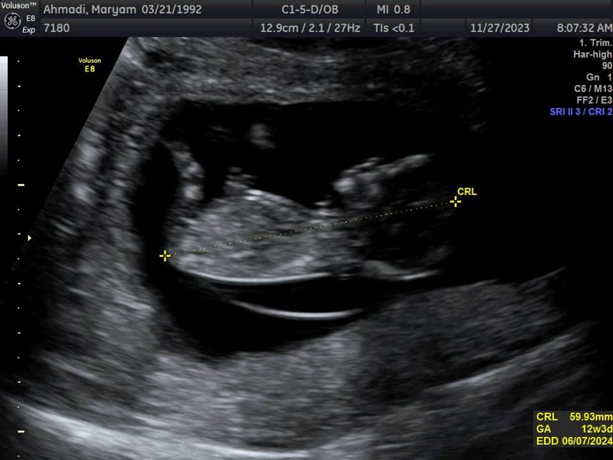 متخصصین تعیین جنسیت لطفا بیاید 😎 متخصصین تعیین جنسیت لطفا بیاید 😎