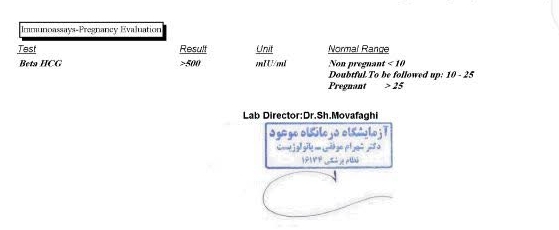 چن روز بعد از بارداری بی بی چک مثبت میشه