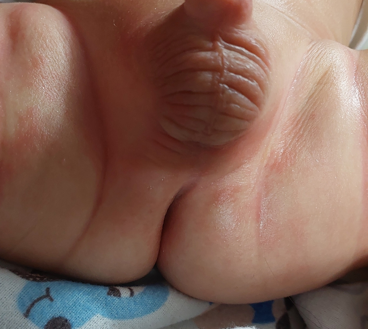 دادن ماست به نوزاد ۵ ماهه دادن ماست به نوزاد ۵ ماهه