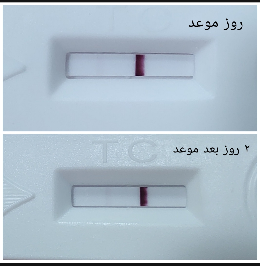 بی بی چک هاله دار و لکه بینی