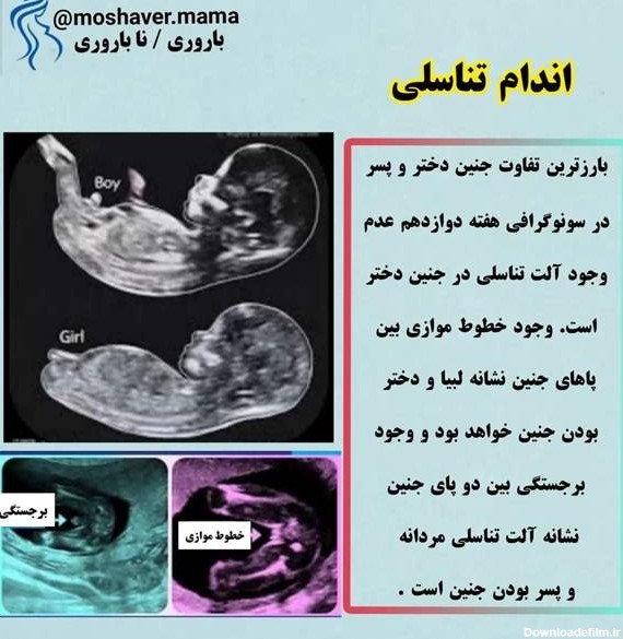 سونو ان تی و بارداری و زایمان سونو ان تی و بارداری و زایمان