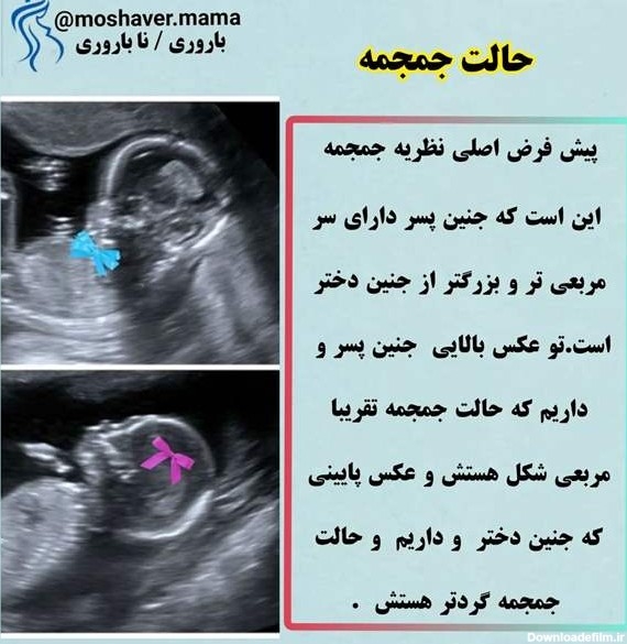 سونو ان تی و بارداری و زایمان سونو ان تی و بارداری و زایمان