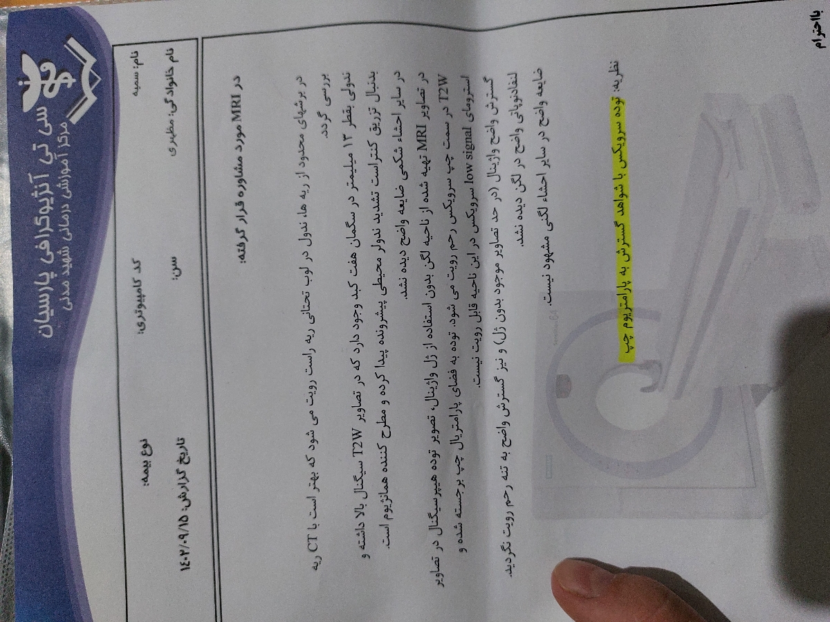 خانم دکتر جواب ام آر ای رو تفسیر میکنید خانم دکتر جواب ام آر ای رو تفسیر میکنید