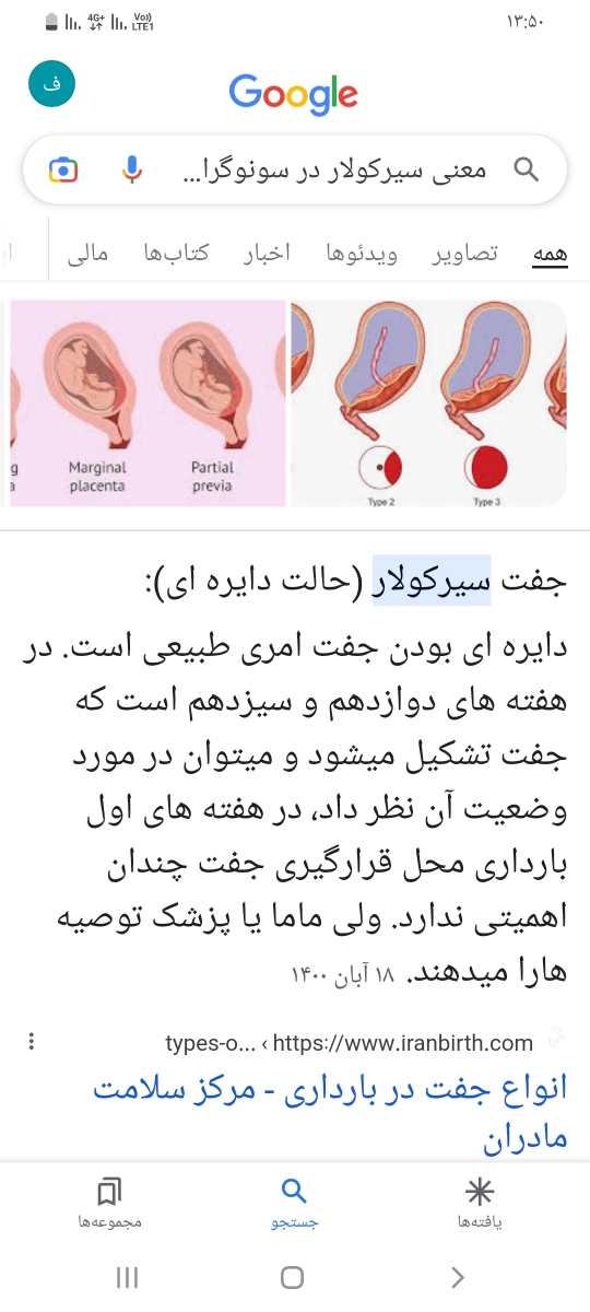 سلام دکتر عزیز و امایی های عزیز امروز سونو قلب دادم