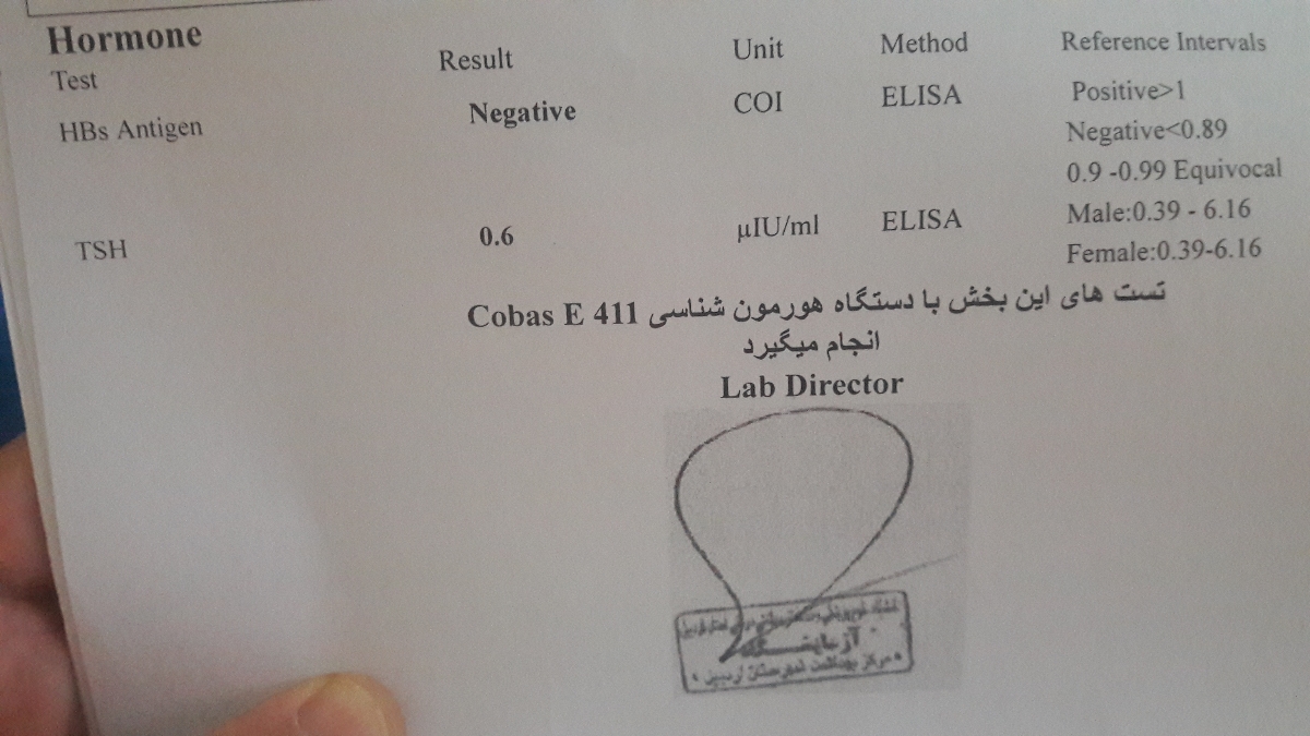 تفسیر ازمایش تیروئید