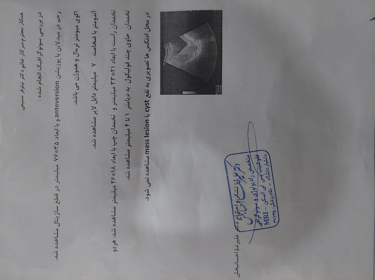تفسیر سونوگرافی بعد از زایمان تفسیر سونوگرافی بعد از زایمان
